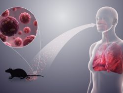 Virus Hanta yang Menginfeksi Buruh Proyek di Ciwidey, Penyebab dan Cara Mengobatinya